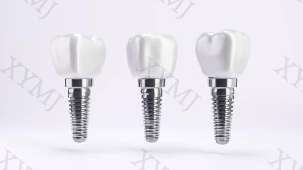 Titanium in Dentistry